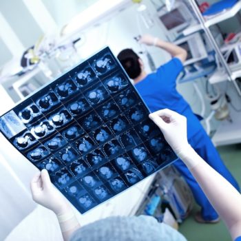 כאבי גב - לאתר את שורש הבעיה על ידי בדיקת MRI /CT