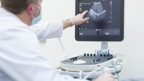 Ultrasound