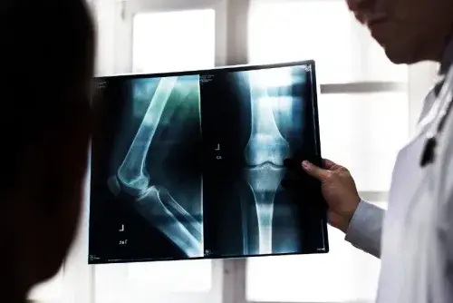 ברך MRI knee